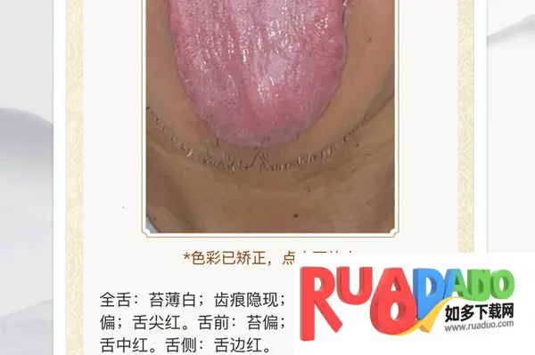 看舌头(舌诊健康软件) 看舌头(舌诊健康软件)